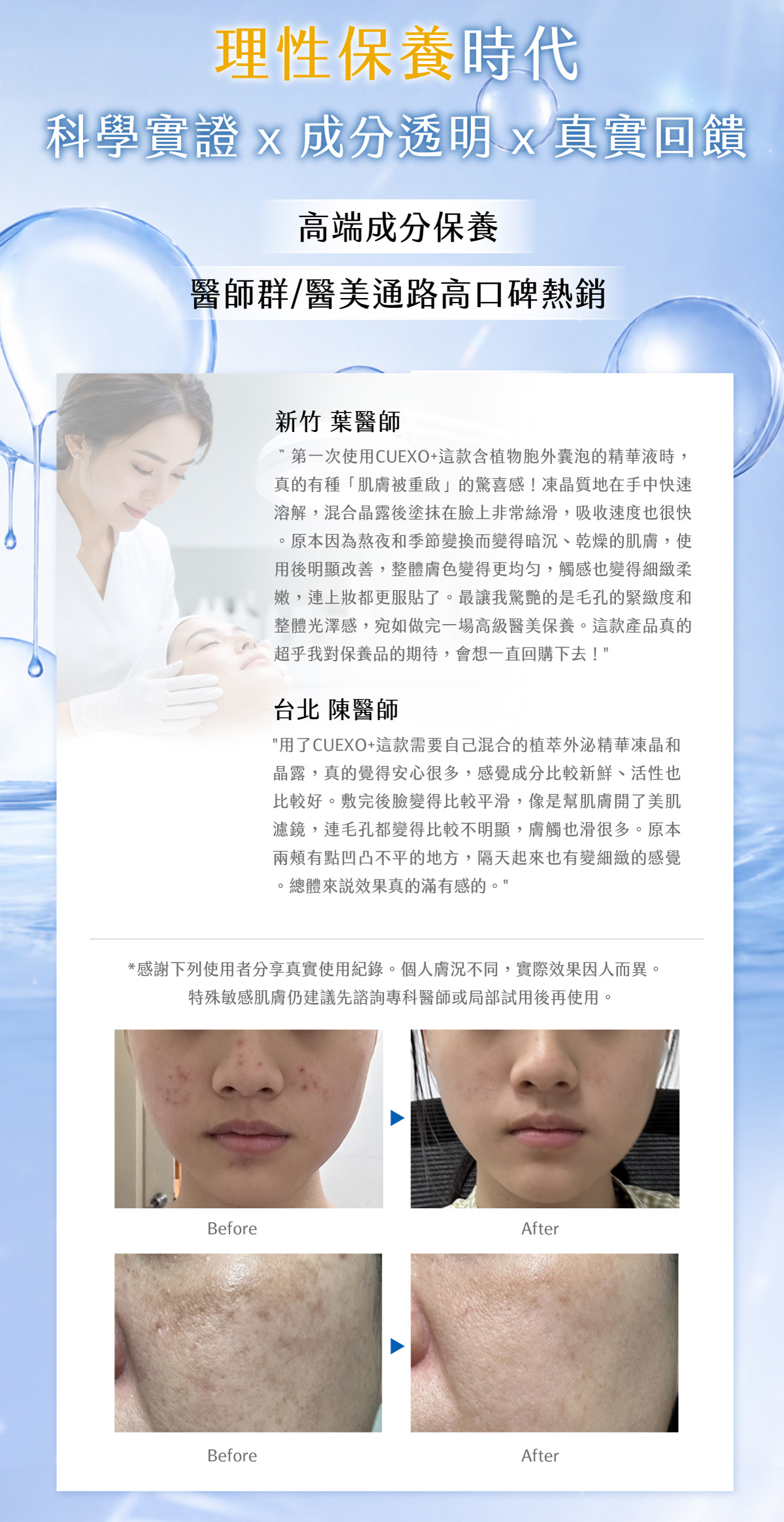 CUEXO+_Exsome-like-PDEVs_brightening_serum_basic09